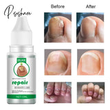 Nail Fungus Treat Onychomycosis Toe Feet Care Repair Anti Infections Paronychia Nails Skin