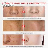 Whitening Freckle Cream Face Remove Dark Spots Melanin Melasma Remover Brightening Skin Effective