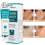 Whitening Freckle Cream Face Remove Dark Spots Melanin Melasma Remover Brightening Skin Effective