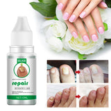 1pc Three Specifica Nail Fungu Serum Fungal Fingernails And Toenails Repair Promote New Growth Renew Cracked Fungal Nail Skin