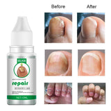 1pc Three Specifica Nail Fungu Serum Fungal Fingernails And Toenails Repair Promote New Growth Renew Cracked Fungal Nail Skin